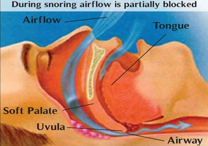 Anti Snoring Breathe Easy Sleep Nose Clip