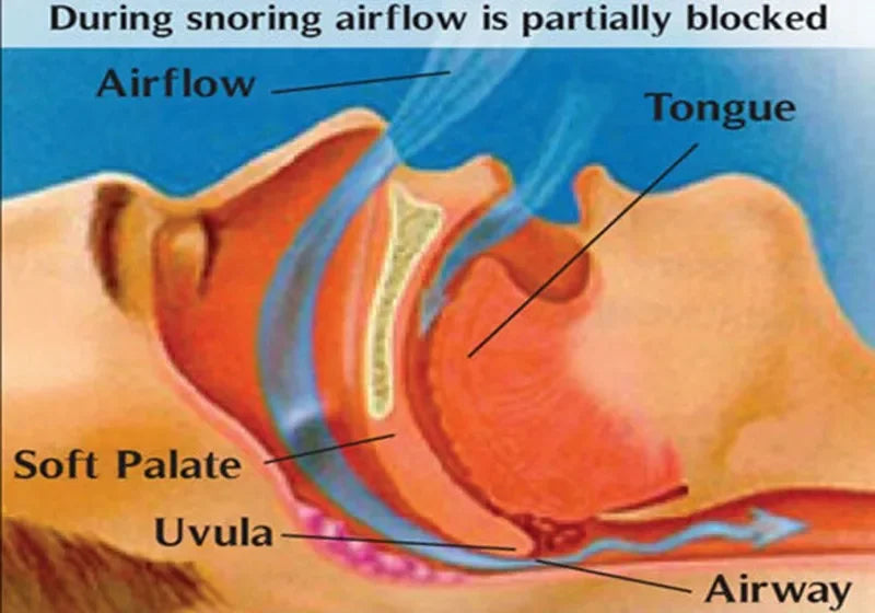 Anti Snoring Breathe Easy Sleep Nose Clip